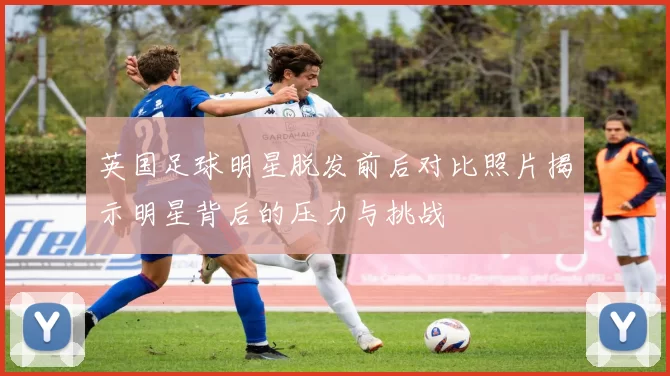 英国足球明星脱发前后对比照片揭示明星背后的压力与挑战